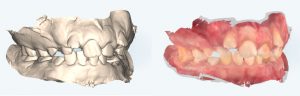 een bewerkte 3D scan